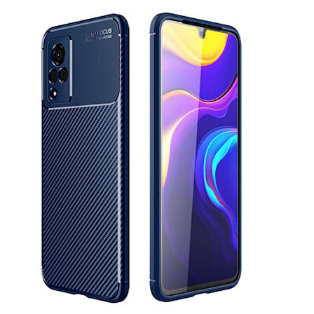 Vivo V21 Kılıf Negro Karbon Görünümlü Silikon Kapak