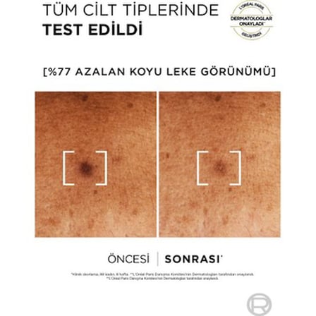 L'Oréal Paris Koyu Leke Karşıtı Serum %10 Niasinamid 30 ml Normal Ciltler İçin