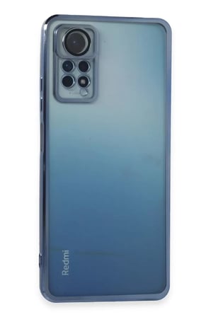 Newface Xiaomi Redmi Note 11 Pro Kılıf Razer Lensli Silikon - Açık Mavi