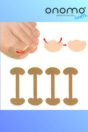 Health Batık Tırnak Düzeltme Bandı 20 Adet