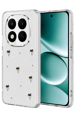 Note 15 Pro Plus 5G Fiyonk Desenli Kapak - Desen 1