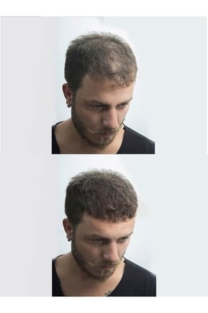 Fibers Saç Dolgunlaştırıcı Kapatıcı - Koyu Kahve