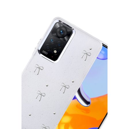 Note 11 Pro Fiyonk Desenli Kapak - Desen 5
