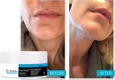 Dr. Botoks Krem 50 ml Zamana Meydan Okuyacak Cildinizin Yeniden Doğuşu Için