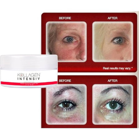Kollagen Intensiv Cream 2 Ad. Zamana Meydan Okuyan Güzelliğinizin Kremi