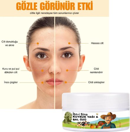 Ibn-I Sina 50 ml Kavanoz Kuyruk Yağı ve Bal Özü / Yüz Bakım Kremi