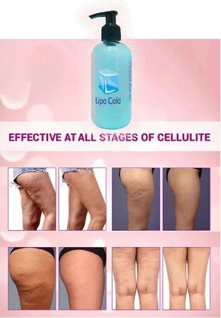 Lipo Cold Seliülitlerinize&fazlalıklarınıza Karşı Soğukkremi 250 ml x 1 Adet