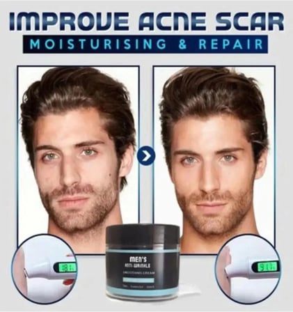 Süper Mens Anti-Wrinkle Cream Erkek Yüz Bakım Kremi 100 ml