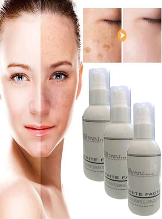 Süper White Factor For Instant Whitening Cilt Bakım Kremi 120 ml Krem x 3 Ad