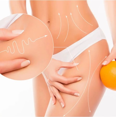 Lipo Jeli - Orijinal Lipo Gel Bölgesel Kullanım Jeli 150ML x 3 Adet