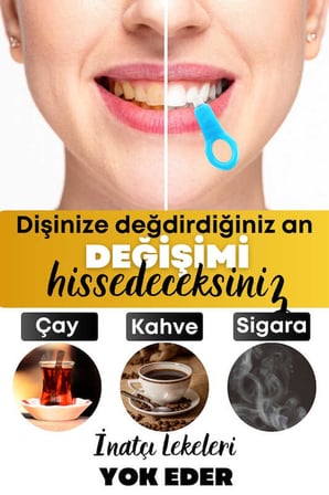 Diş Leke Silgisi 1 Aparatlı + 5 Yedek Süngerli Set 1 Paket