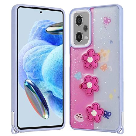 Forzacase Xiaomi Redmi Note 12 Pro 5G ile uyumlu Cute Serisi Parlayan Simli Kabartma Figürlü Kılıf