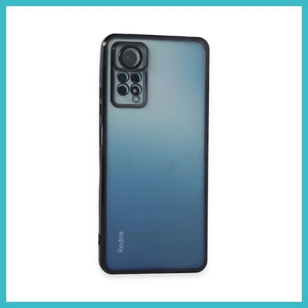 DEFNE STORE Redmi Note 11 Pro Uyumlu Kılıf Lensli Silikon - Siyah DFNBEZ