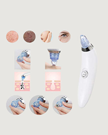 Vakum Teknolojili Siyah Nokta Temizleyici Cihaz – 4 Farklı Başlık ve Derinlemes