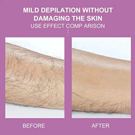 Dodes Epilatör Kristal Epilasyon Aleti