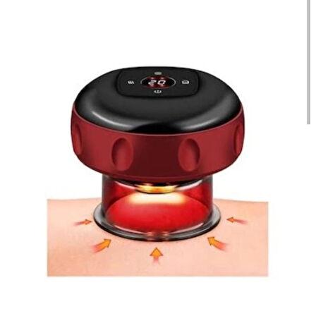 Dodes Vakumlu Hacamat Kupası, Şarjlı Kupa Çekme Hacamat Led Işıklı Masaj ve Selülit Kupası