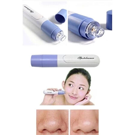 Dodes Pore Cleaner Vakumlu Yüz Temizleme Siyah Nokta Temizleme Cihazı