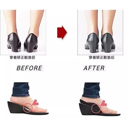 Esnek Düz Taban Düzeltici Topuk Yastığı