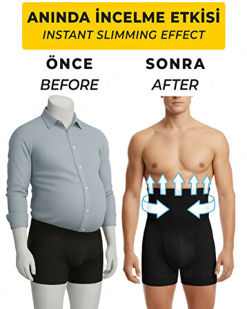 Opex Bel ve Göbek Korse Boxer – Yüksek Bel, Karın Toparlayıcı ve Sıkılaştırıcı, Siyah