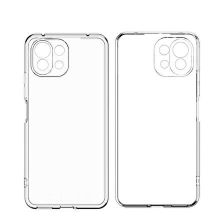 Xiaomi Mi 11 Uyumlu kamera korumalı Yumuşak Dokulu ve Şık Koruma Şeffaf Kılıf