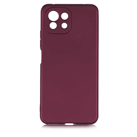 Xiaomi Mi 11 Lite Uyumlu Kılıf Esnek ve Darbe Emici Renkli Koruyucu Kapak
