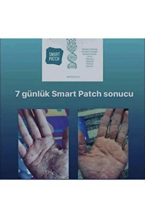 Smart Patch Medikal Ağrı Bantı