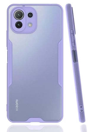 Xiaomi Mİ 11 Lite Kılıf Platin Silikon - Lila