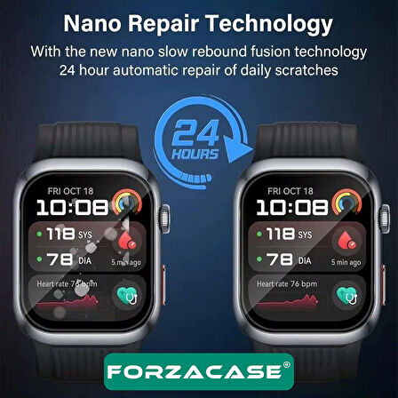 Forzacase Huawei Watch D2 için Çerçeveli Tam Kaplayan 3D Pet Ekran Koruyucu Film - FC016