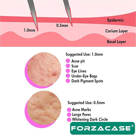 Forzacase Dermaroller 0.5 mm 540 İğneli Masaj Aleti Saç Skin Cilt Tarağı  - FC837