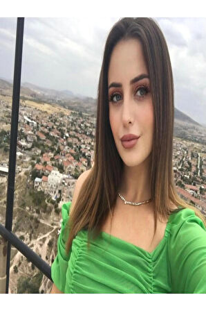 ÇELİK KOLYE FOTOĞRAF BASKILI KOLYE İSTEDİĞİNİZ GÖRSEL BASILIR 316L 1 YIL RENK GARANTİLİ GOLD 45 CM