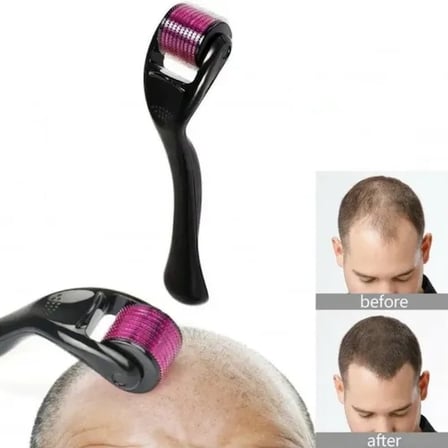 Hediyelik Derma Roller 0.5 mm Titanyum İğneli Cilt Bakım Aleti