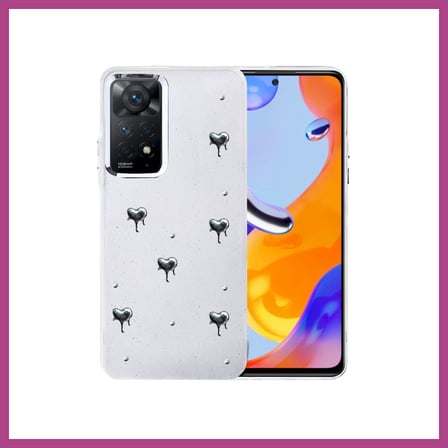 STR STORE Redmi Note 11 Pro Uyumlu Fiyonk Desenli Kapak - Desen 1 GBZS
