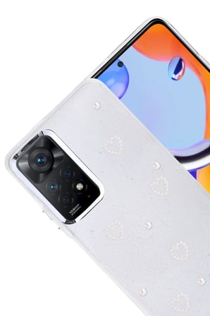 STR STORE Redmi Note 11 Pro Uyumlu Fiyonk Desenli Kapak - Desen 10 GBZS