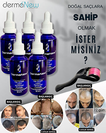 DERMANEW HAİR Sac Bakım Yağı - Saç Gürleştirici - Serum - Saç Yağı - Hair ( 5 Serum + Roller )