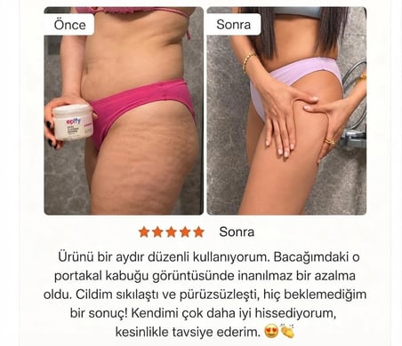 Soğuk Etkili Sıkılaştırıcı & Portakal Kabuğu Görünümü Karşıtı Selülit Jeli