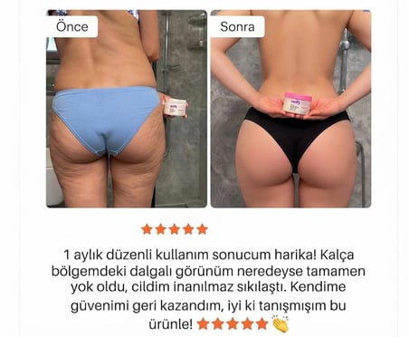 Soğuk Etkili Sıkılaştırıcı & Portakal Kabuğu Görünümü Karşıtı Selülit Jeli