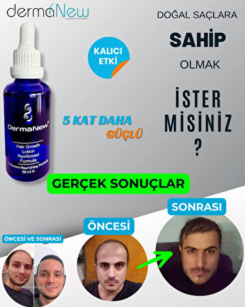 Saç Losyonu Saç Bakım Yağı - saç gürleştirici - saç yağı lotion / 5 Adet Serum+ Şampuan + Roller