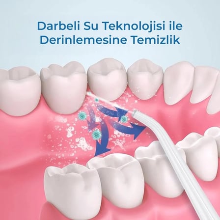 Katjmer KJ/AD-001 6886 Aquadent Ağız Duşu