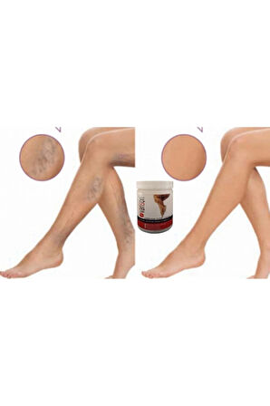 Varison Va.ris Selü.lit Bacak Bakım Kremi 200 ml X 2adet