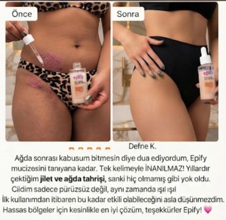 Dual Phase 'Teknolojisi Çift Fazlı Tüy Azaltıcı Serum 