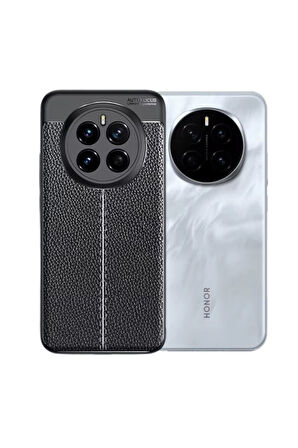 Honor Magic 7 Pro Uyumlu Silikon Kılıf Deri Desenli Kamera Korumalı Darbe Emici Autofocus Kapak