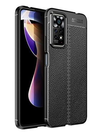 Redmi Note 11 Pro Deri Desenli Silikon Kılıf - Ultra Darbe Emici Kamera Korumalı Kapak
