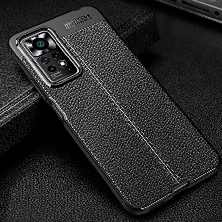 Redmi Note 11 Pro Deri Desenli Silikon Kılıf - Ultra Darbe Emici Kamera Korumalı Kapak
