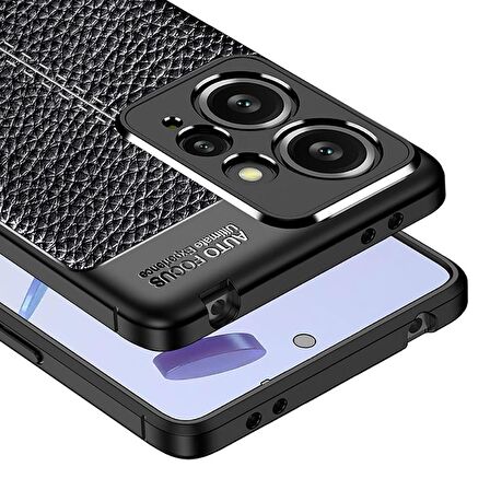 Redmi Note 12 4G Deri Desenli Silikon Kılıf - Ultra Darbe Emici Kamera Korumalı Kapak