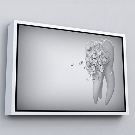 Beyaz Çerçeveli Diş Kliniği Duvar Tablosu, Çürüyen Diş, Diş Hekimi Tablo