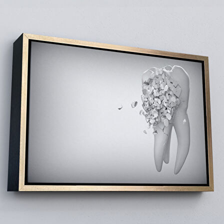 Siyah Çerçeveli Diş Kliniği Duvar Tablosu, Çürüyen Diş, Diş Hekimi Tablo