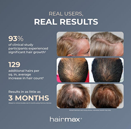 Hairmax Ultima 9 Classic LaserComb Lazer Saç Büyütme Cihazı
