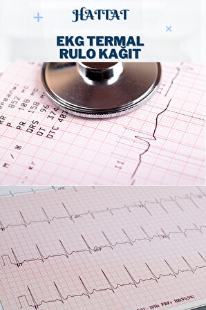 12 Adet Rulo EKG ECG 210mmx20metre Tam Metrajlı Yüksek Kaliteli Hassas Karelajlı Rulo Termal Kağıt