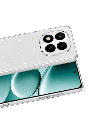 Newface Xiaomi Redmi Note 15 Pro 5G Fiyonk Desenli Kapak - Desen 10