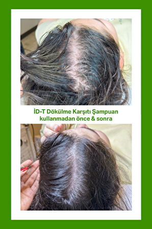 Dökülme Karşıtı Şampuan Hızlı Saç Uzaması Biotin Ve Keratin
